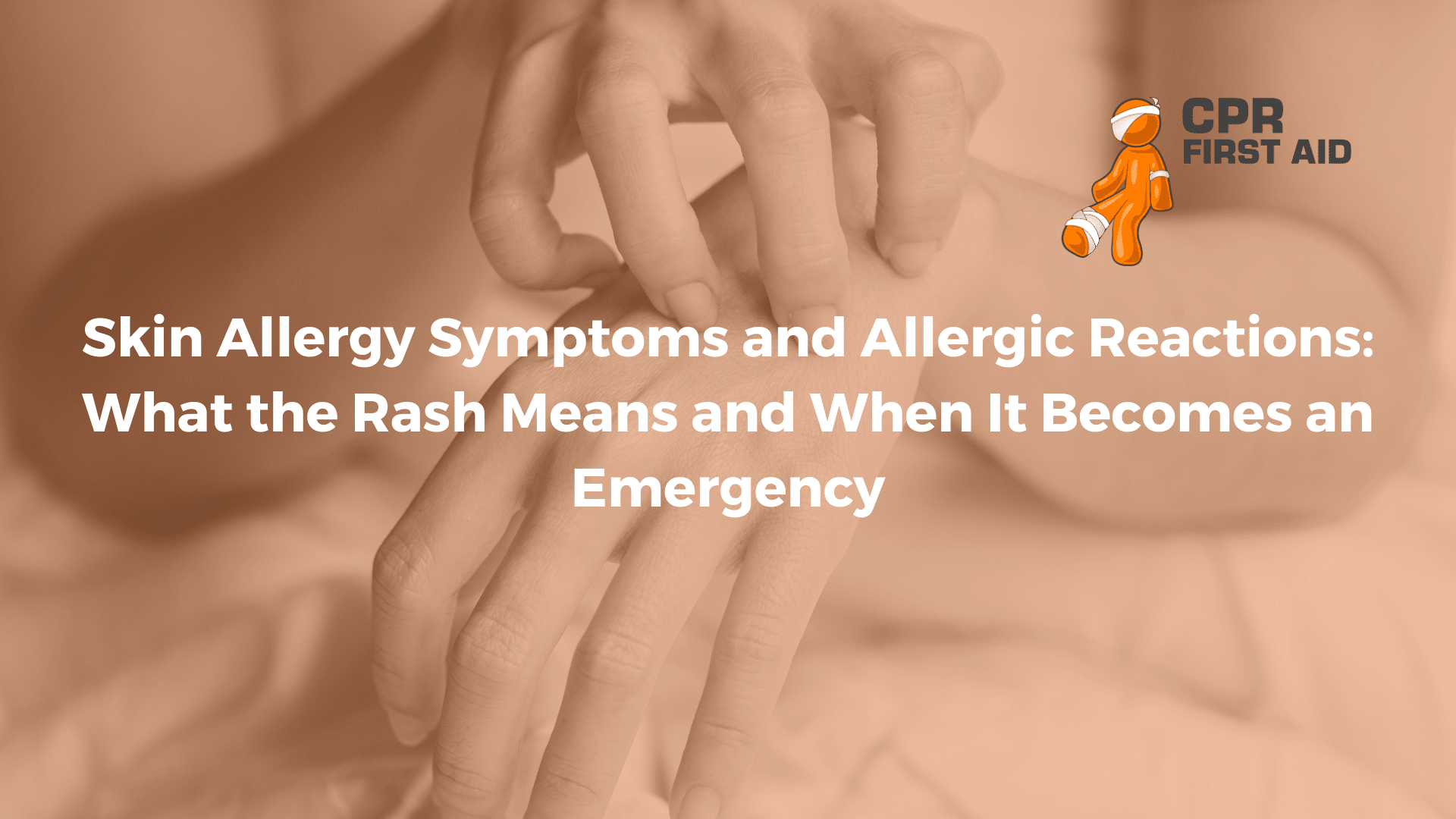 Skin Allergy Symptoms and Allergic Reactions: What the Rash Means and When It Becomes an Emergency